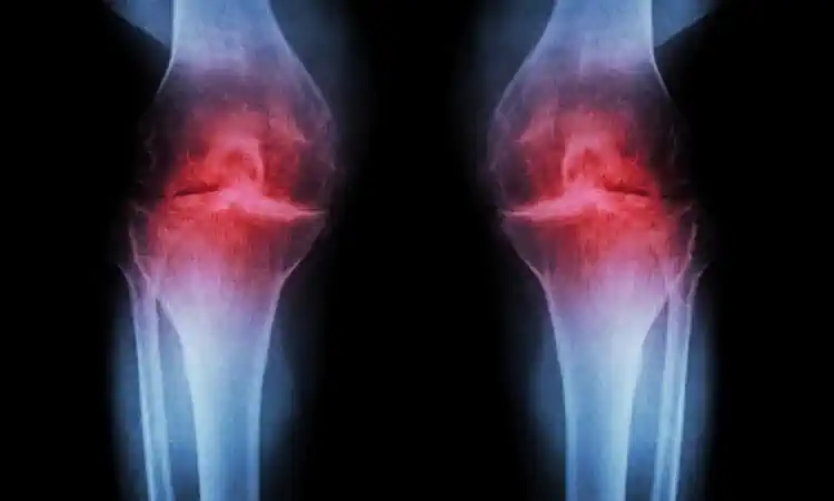 ������� ������ � ��������� ������� ����� �������� ���� ���� � ������